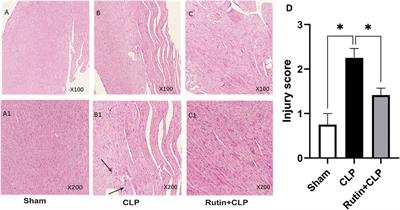 Rutin Inhibits Cardiac Apoptosis and Prevents Sepsis-Induced Cardiomyopathy